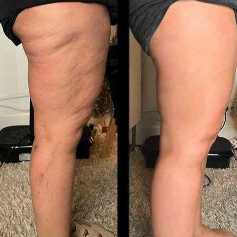 Cienne Lymphatic Drainage – Herbal Detox Drops