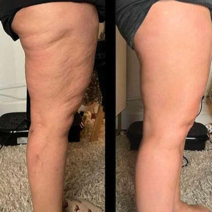 Cienne Lymphatic Drainage – Herbal Detox Drops