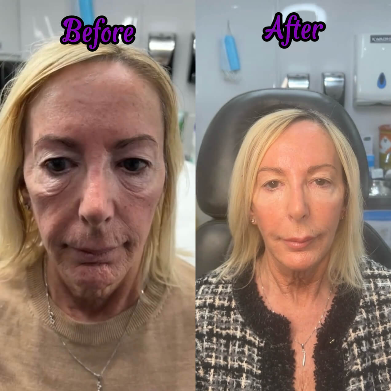 Cienne Calcium Anti-Aging Multi Balm